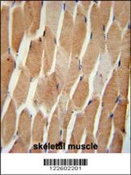 COQ7 Antibody (C-term)