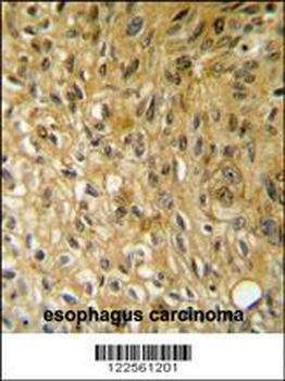 SAMSN1 Antibody (Center)