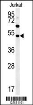 SAMSN1 Antibody (Center)