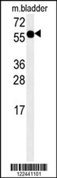 ADSSL1 Antibody (N-term)