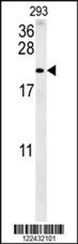 TAC1 Antibody (C-term)
