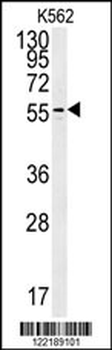 PAOX Antibody (Center)