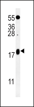 VAMP4 Antibody (Center)