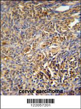 TANK Antibody (Center)