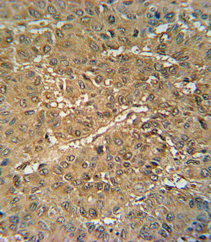 VKORC1 Antibody (N-term)