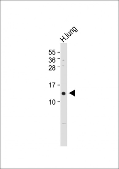 VKORC1 Antibody (N-term)
