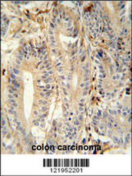 MEP1A Antibody (N-term)