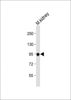 MEP1A Antibody (N-term)