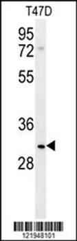 LRRC52 Antibody (C-term)