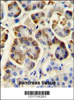 KCNJ6 Antibody (Center)