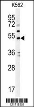 KCNJ6 Antibody (Center)