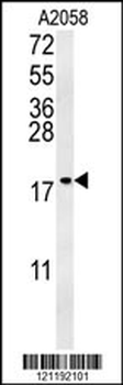 GM2A Antibody (N-term)