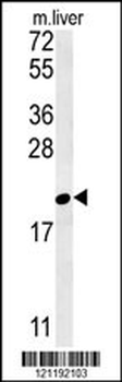 GM2A Antibody (N-term)