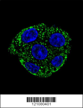 GSTO2 Antibody (Center)