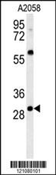 GSTO2 Antibody (Center)