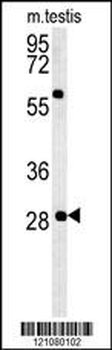 GSTO2 Antibody (Center)