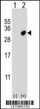 GSTO2 Antibody (Center)