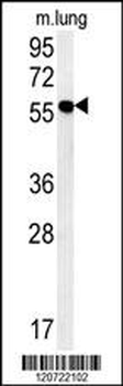 ZMYND10 Antibody (C-term)