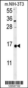 LSM4 Antibody (Center)