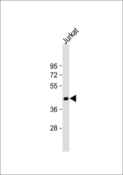 ST3GAL5 Antibody (C-term)