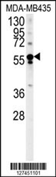 ARHGEF3 Antibody (Center)