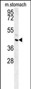 FAM26E Antibody (C-term)