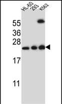TMEM40 Antibody (N-term)
