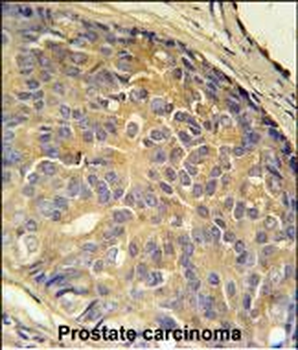 LOH12CR1 Antibody (C-term)
