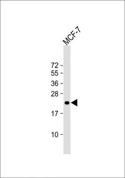 LOH12CR1 Antibody (C-term)