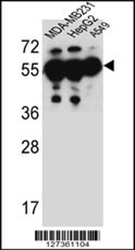 ANKRD57 Antibody (C-term)