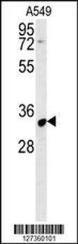 KCNK7 Antibody (C-term)