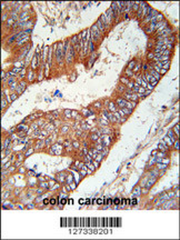 KLHL6 Antibody (C-term)