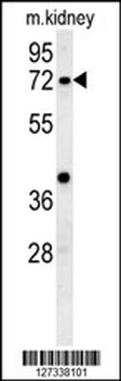 KLHL6 Antibody (C-term)