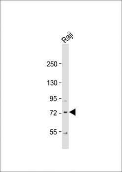 KLHL6 Antibody (C-term)