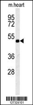 KCNV1 Antibody (N-term)