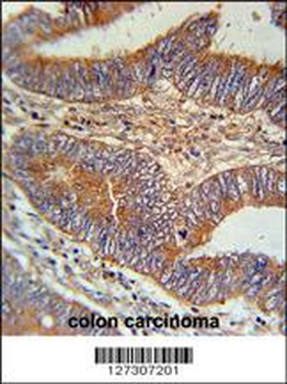 BIN2 Antibody (N-term)