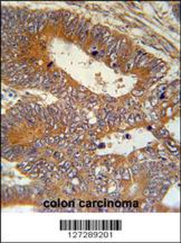 MAP1S Antibody (Center)