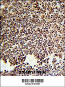 KIR2DS3 Antibody (C-term)