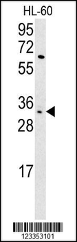 KIR2DS3 Antibody (C-term)