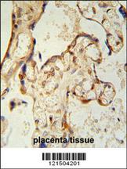 PON2 Antibody (Center)