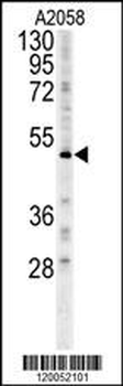 FOXC2 Antibody (Center S174)