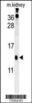 HRASLS3 Antibody (C-term)