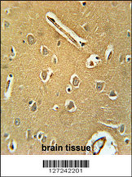 RNF208 Antibody (Center)