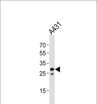 RNF208 Antibody (Center)