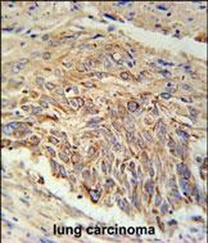 EBPL Antibody (C-term)
