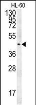 PGAP2 Antibody (C-term)