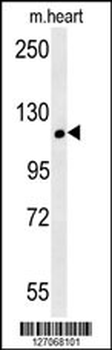 CRUM2 Antibody (C-term)