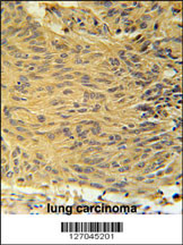 LCLT1 Antibody (C-term)