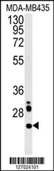 LHPL3 Antibody (C-term)