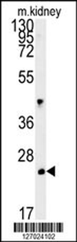 LHPL3 Antibody (C-term)